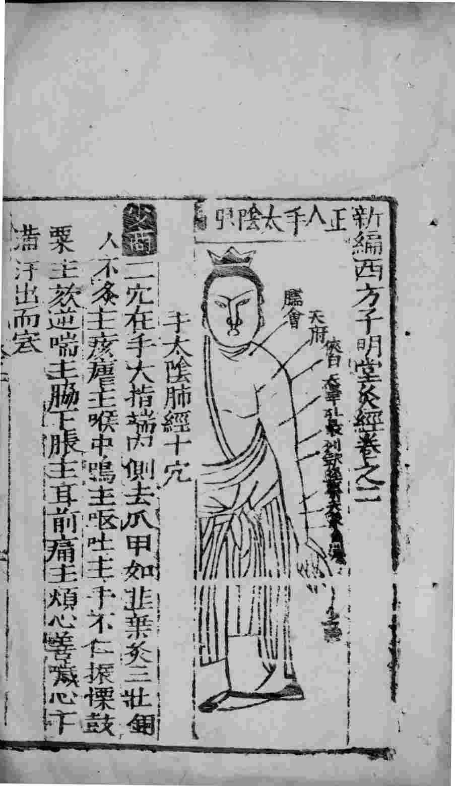 新编西方子明堂灸经  卷2